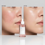 Before-After Apaisant